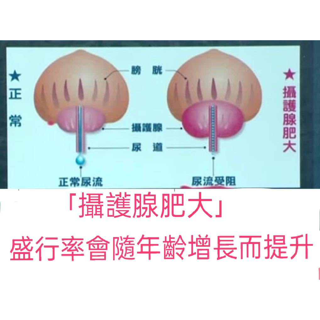 抓龍筋 男士私密養護（北中南）