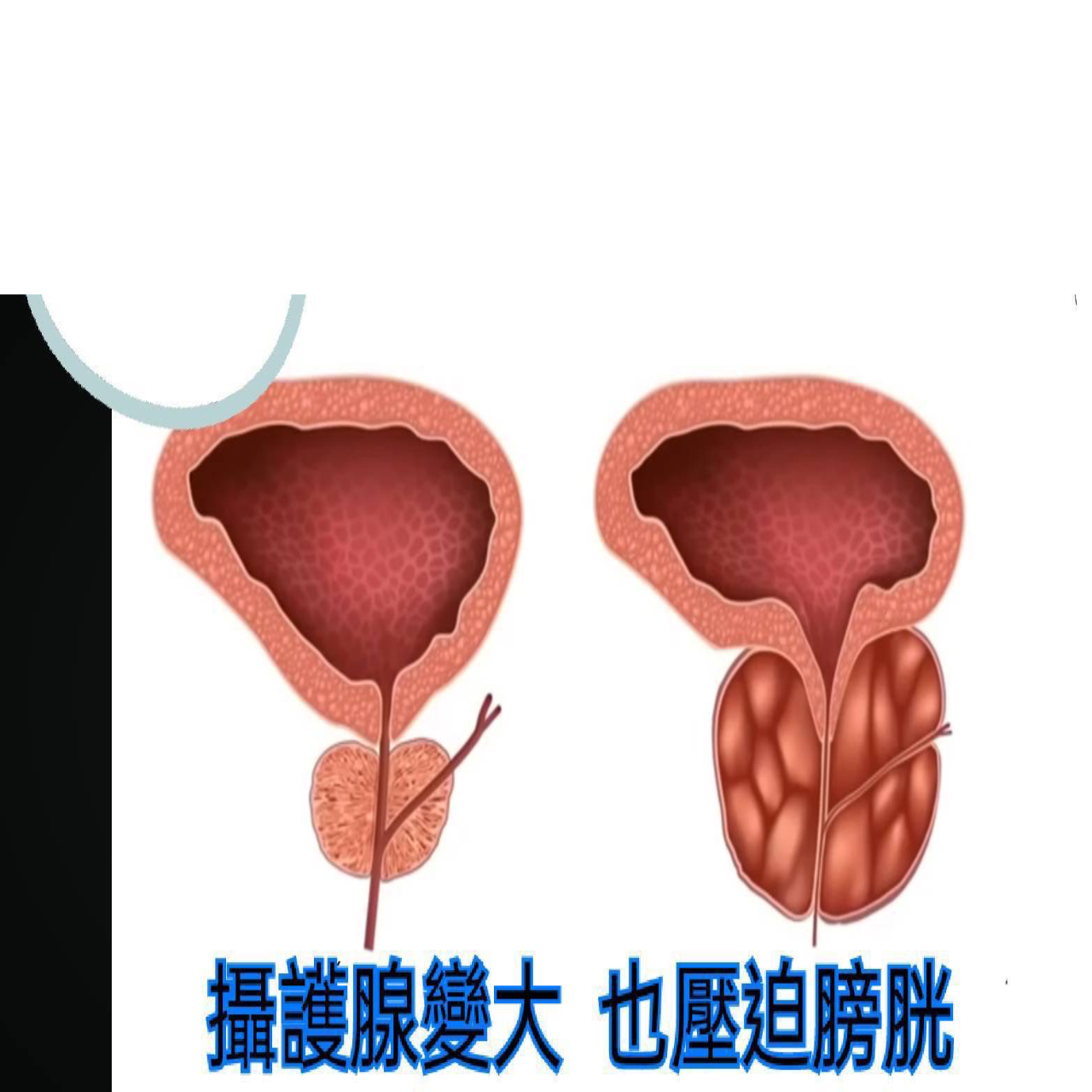 抓龍筋 男士私密養護（北中南）