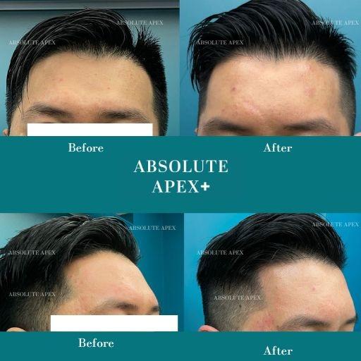 ABSOLUTE APEX MEDICAL  柏和醫療