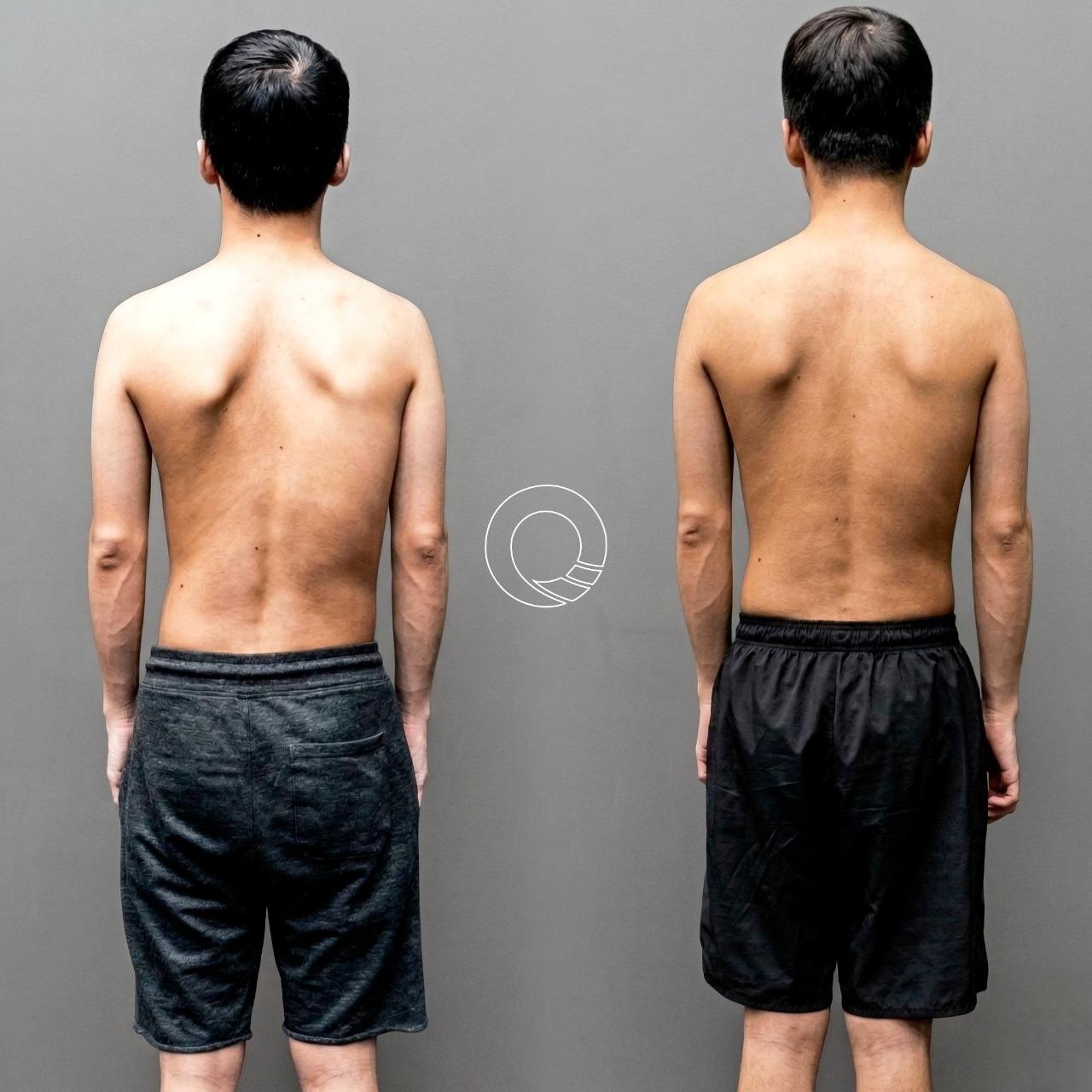 凝聚運動顧問｜結構與功能｜身體恢復中心 結構整合訓練重回正位