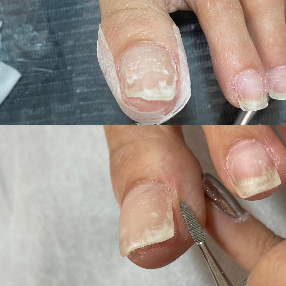 繭美學工作室｜台南暈染美甲·溫熱蠟除毛 台南崁甲處理