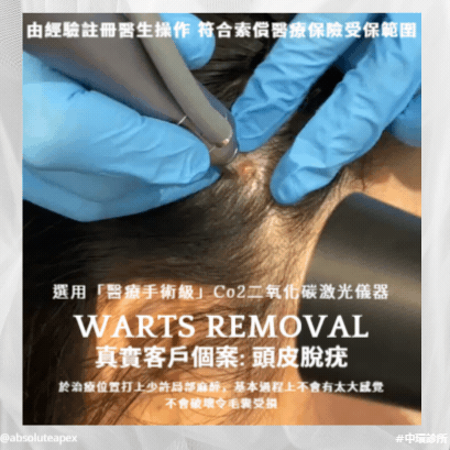 ABSOLUTE APEX MEDICAL  柏和醫療 脫疣均為專業驗經註冊醫生操作👍常見於面、眼、頸、及其它身體部位，由於傳染性極高、伴隨痕癢及影響外觀應及早處理！