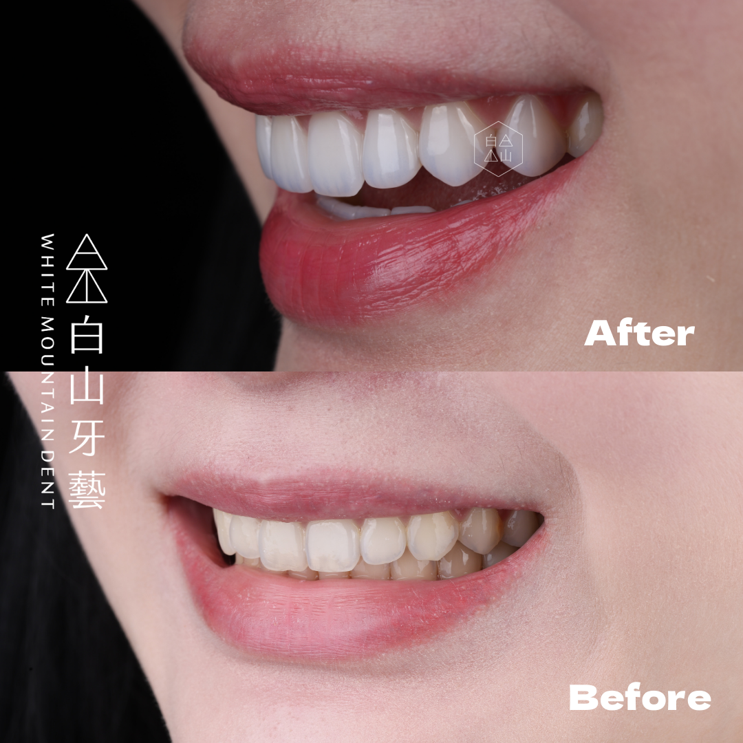 白山牙藝｜WHITE MOUNTAIN DENT