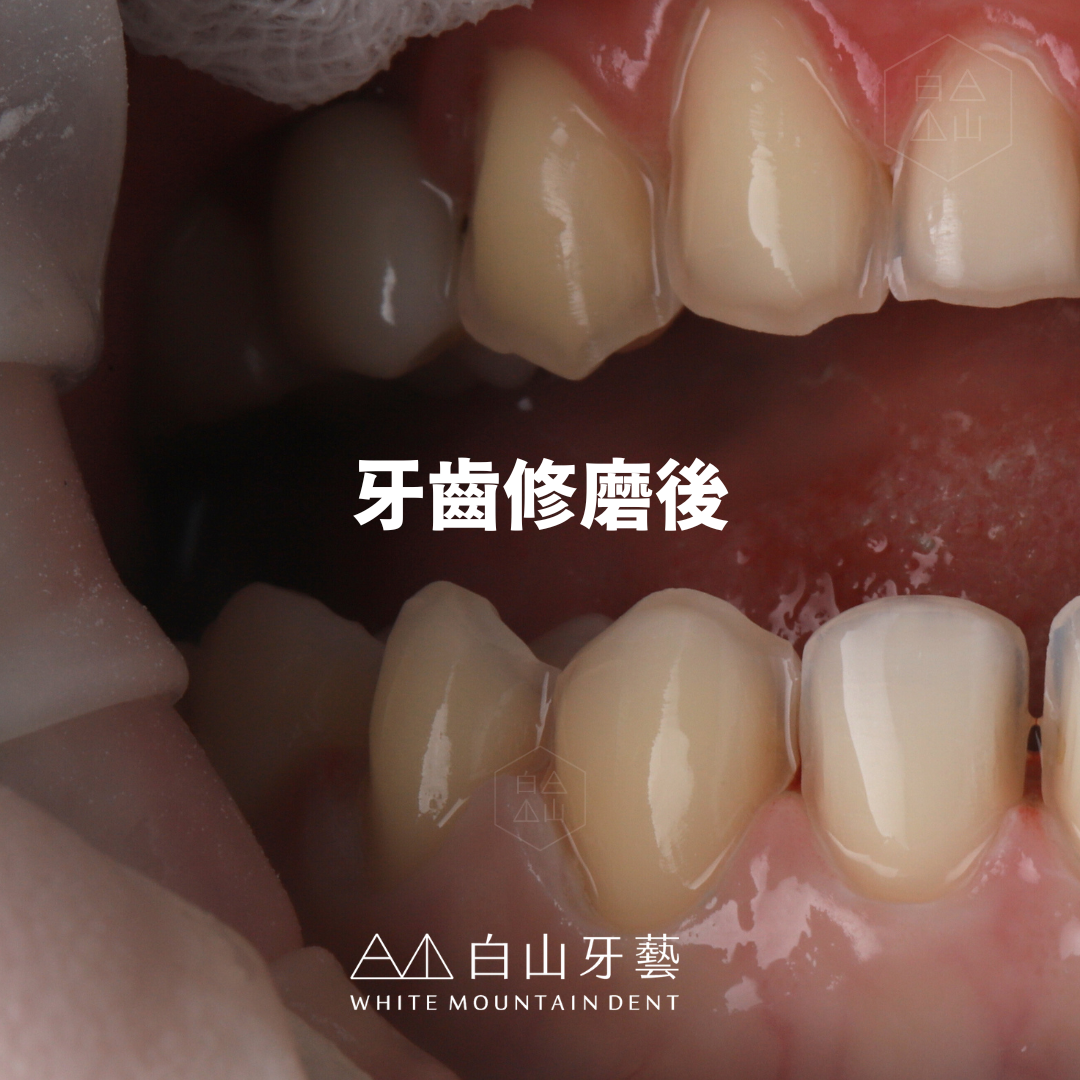 白山牙藝｜WHITE MOUNTAIN DENT