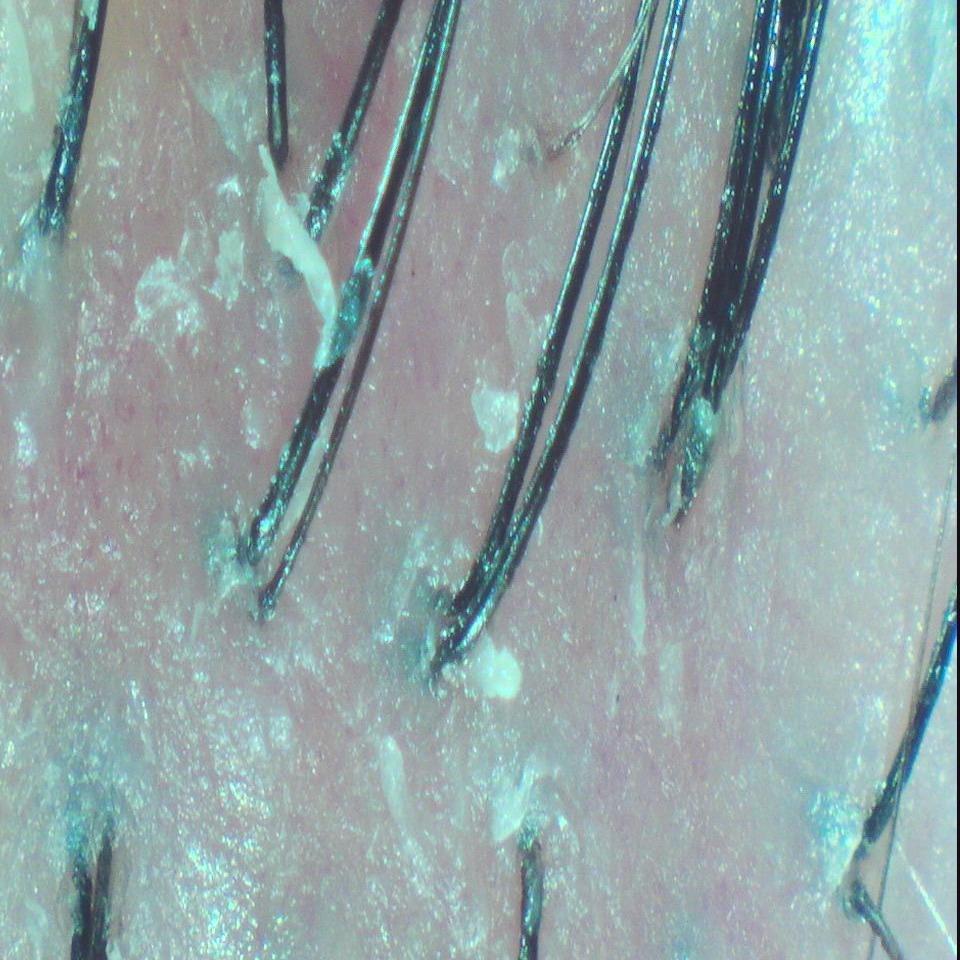 森挪威頭皮養護旗艦店