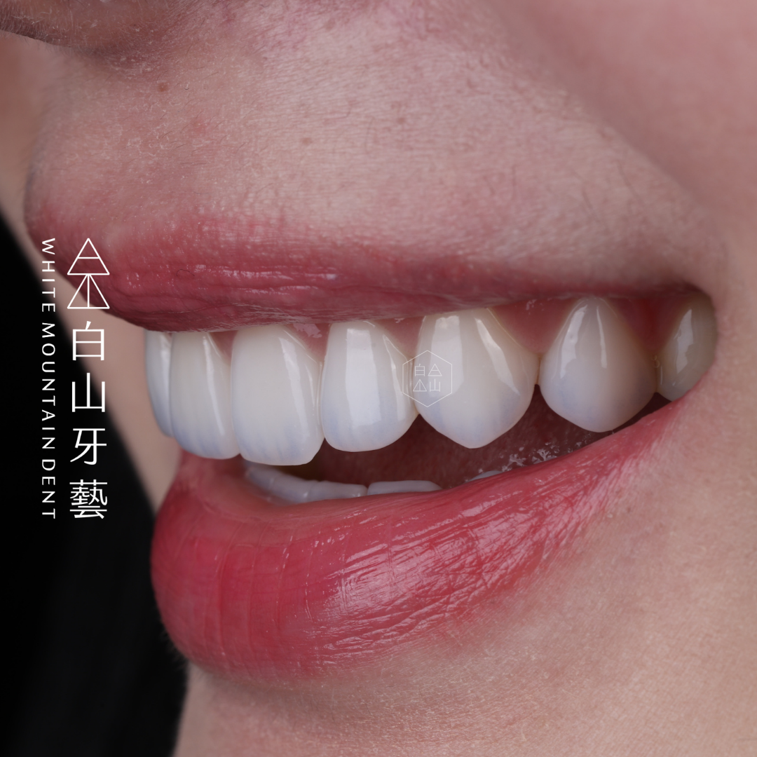 白山牙藝｜WHITE MOUNTAIN DENT