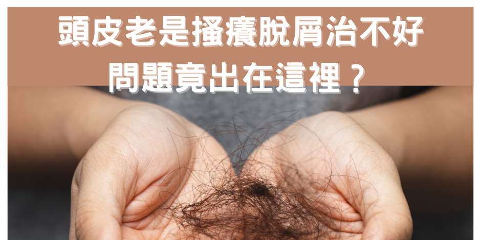 皮膚科 王宣甯醫師 【衛教天地】頭皮老是搔癢脫屑治不好，問題竟出在這裡？