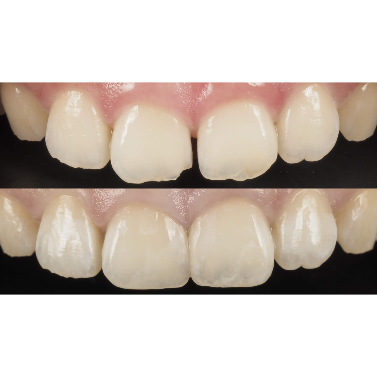 黃建勳 牙醫師 術後