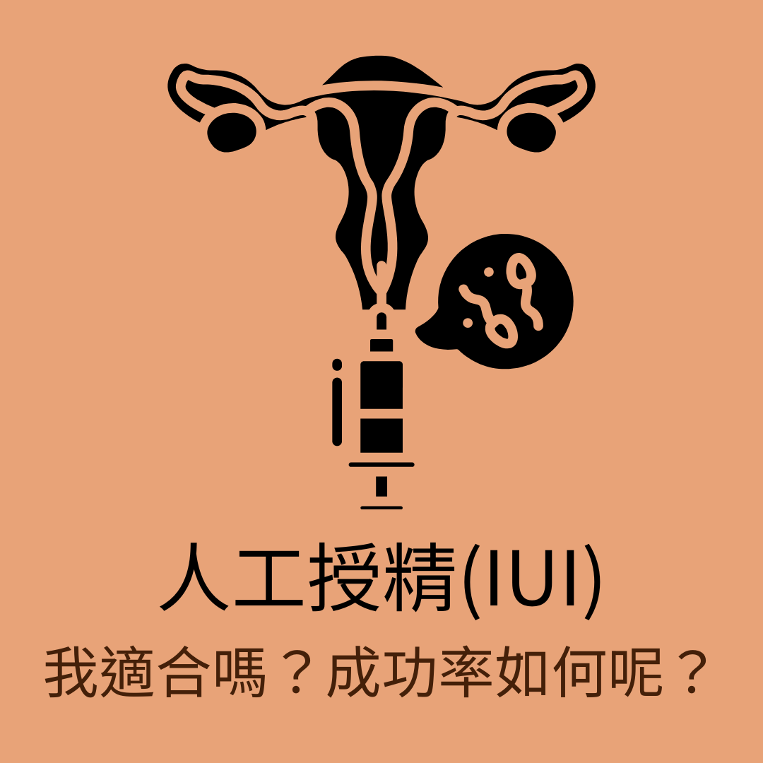女性醫學*子晴醫師 人工授精IUI