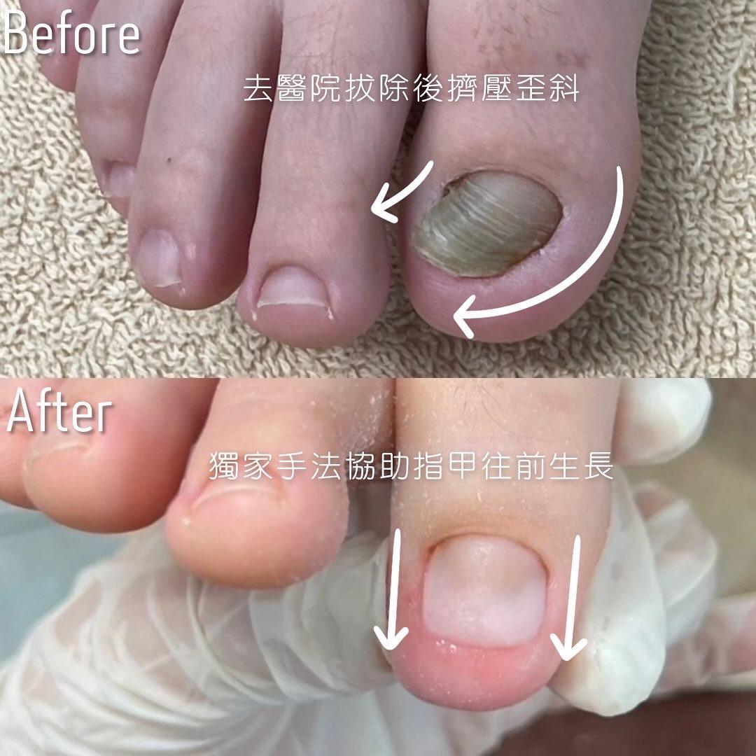 獨家指甲調整BA圖