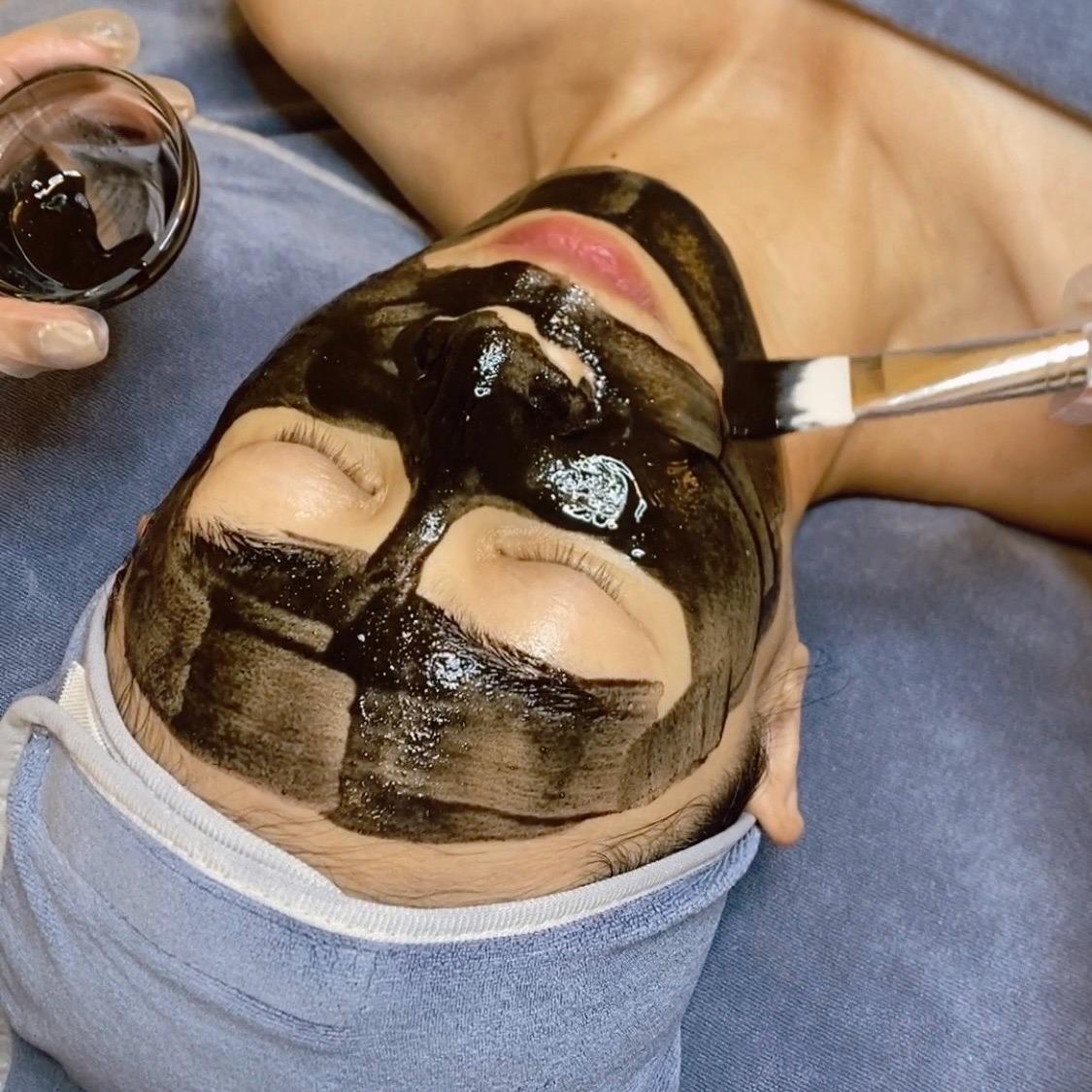 MN13 所有膚質都適用｜暢通毛孔｜改善暗沉、痘印