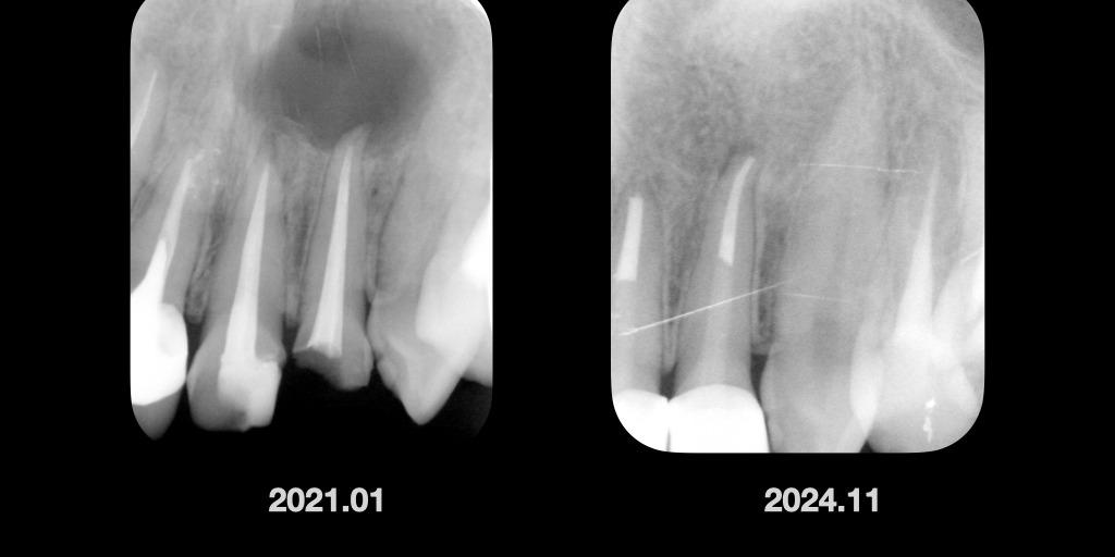 張益彰醫師 | 衛福部定牙髓病專科 顯微根管