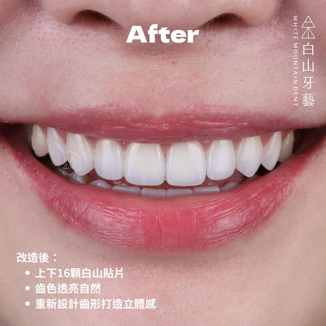 白山牙藝｜WHITE MOUNTAIN DENT