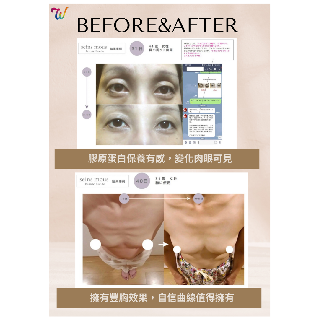 W美胸專業沙龍 台中南屯總店