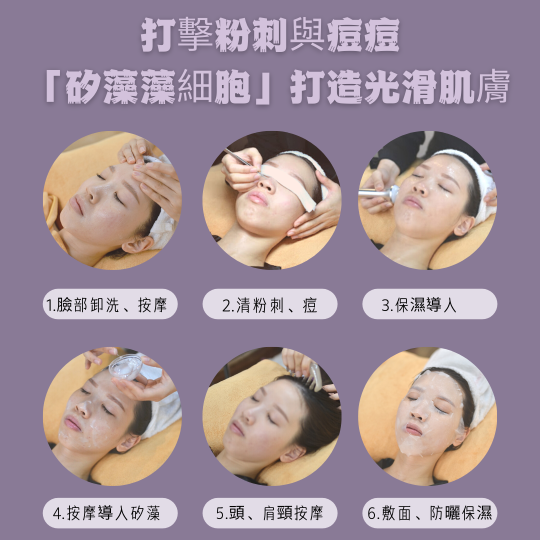 矽藻藻細胞/藻針