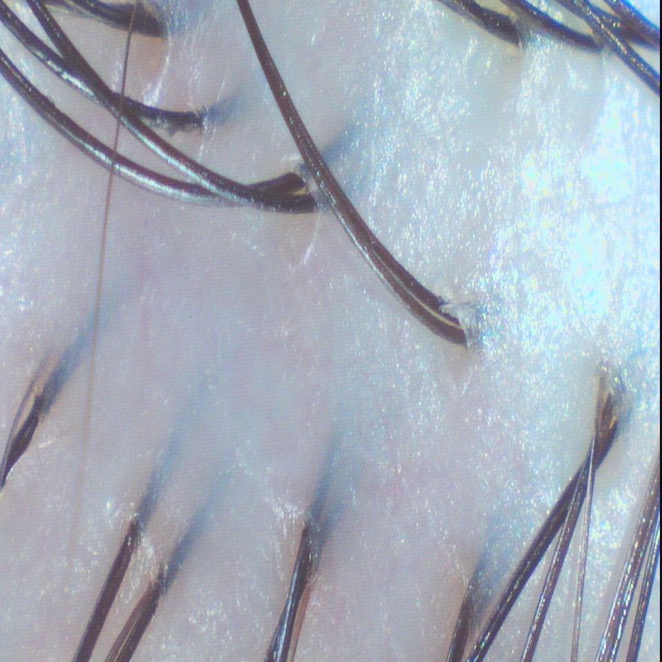 森挪威頭皮養護旗艦店 舒緩  After