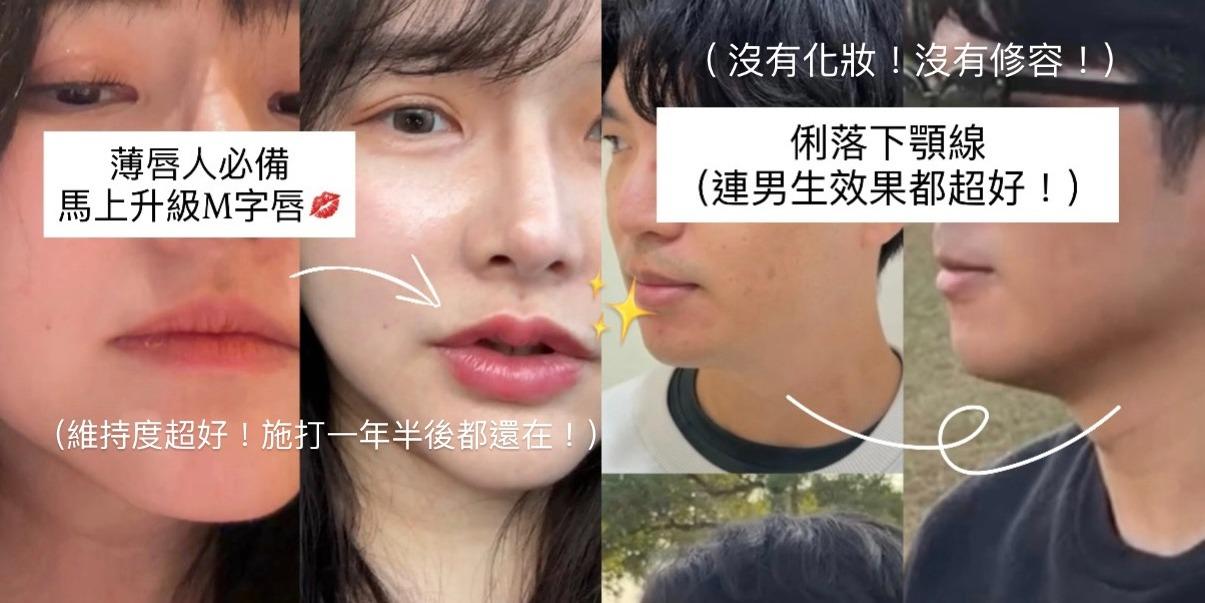 台中好媳婦Una的好物分享！ 花小錢變精緻！玻尿酸嘴唇 & 音波真的是CP值最高的投資✨ 北中南都有診所！李多慧推薦診所