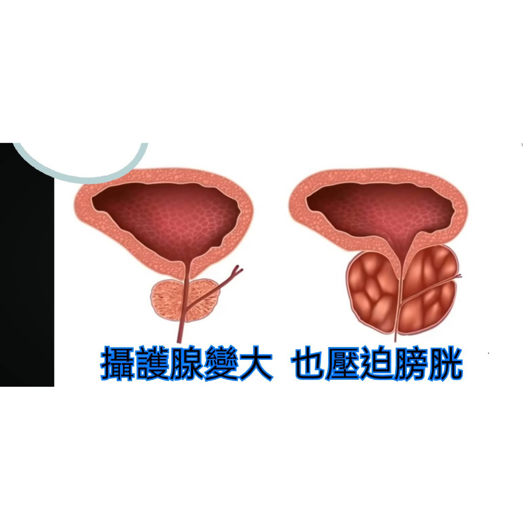 泰式龍筋保養