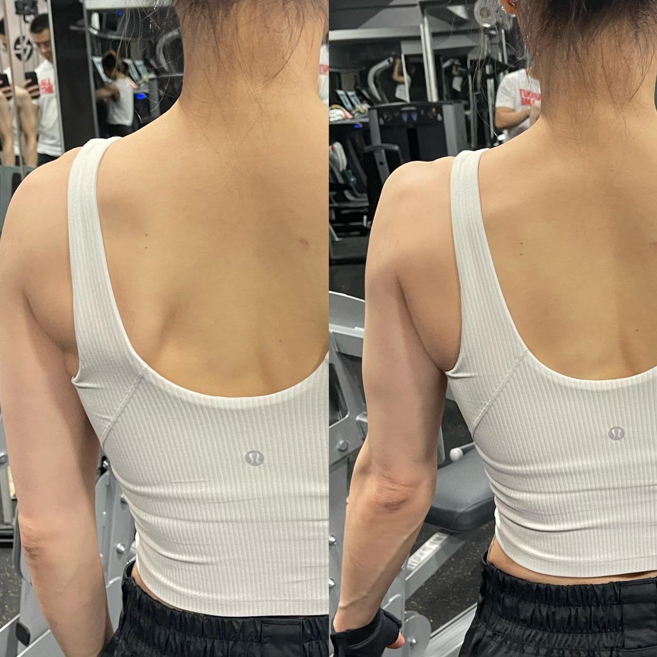 JASON LAI ︳健身教練及培訓師 客戶例子:翼狀肩胛改善✨