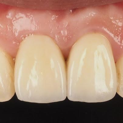 黃建勳 牙醫師 假牙自然對稱