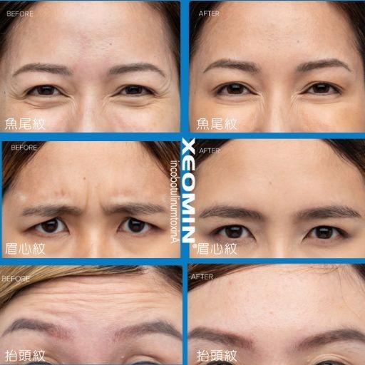 ABSOLUTE APEX MEDICAL  柏和醫療