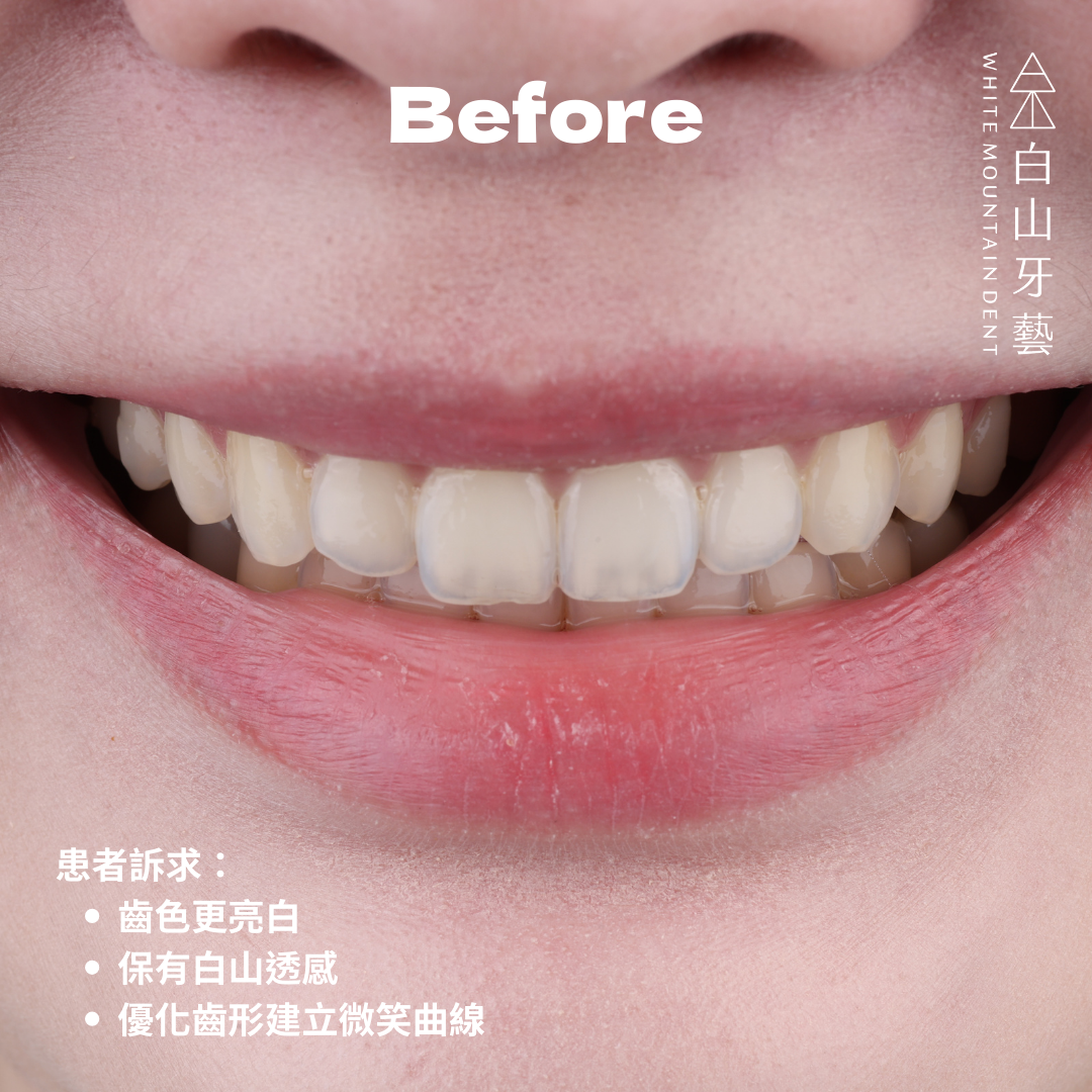 白山牙藝｜WHITE MOUNTAIN DENT