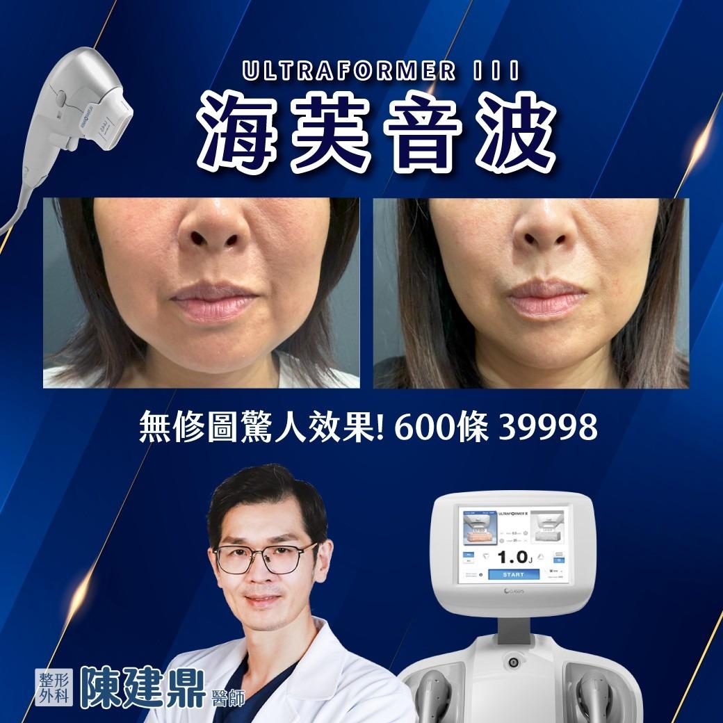 🔔 叮咚醫師 🔔 整型外科 陳建鼎醫師 🔔電波&音波