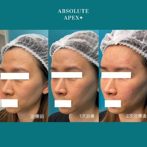 ABSOLUTE APEX MEDICAL  柏和醫療