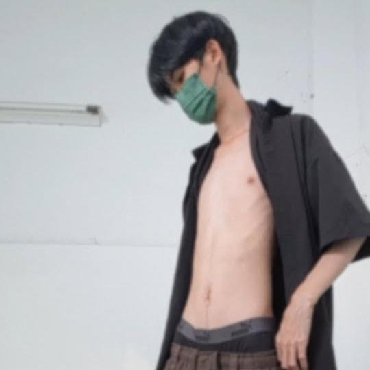 ABloss
