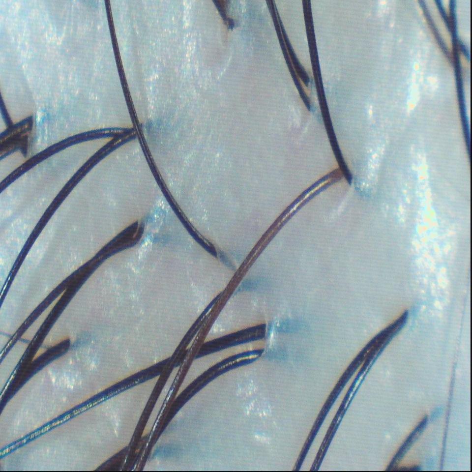 森挪威頭皮養護旗艦店 乾性皮屑  After