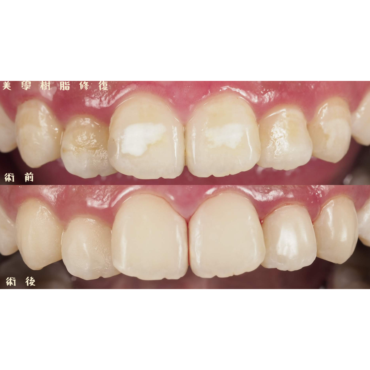 黃建勳 牙醫師 術前