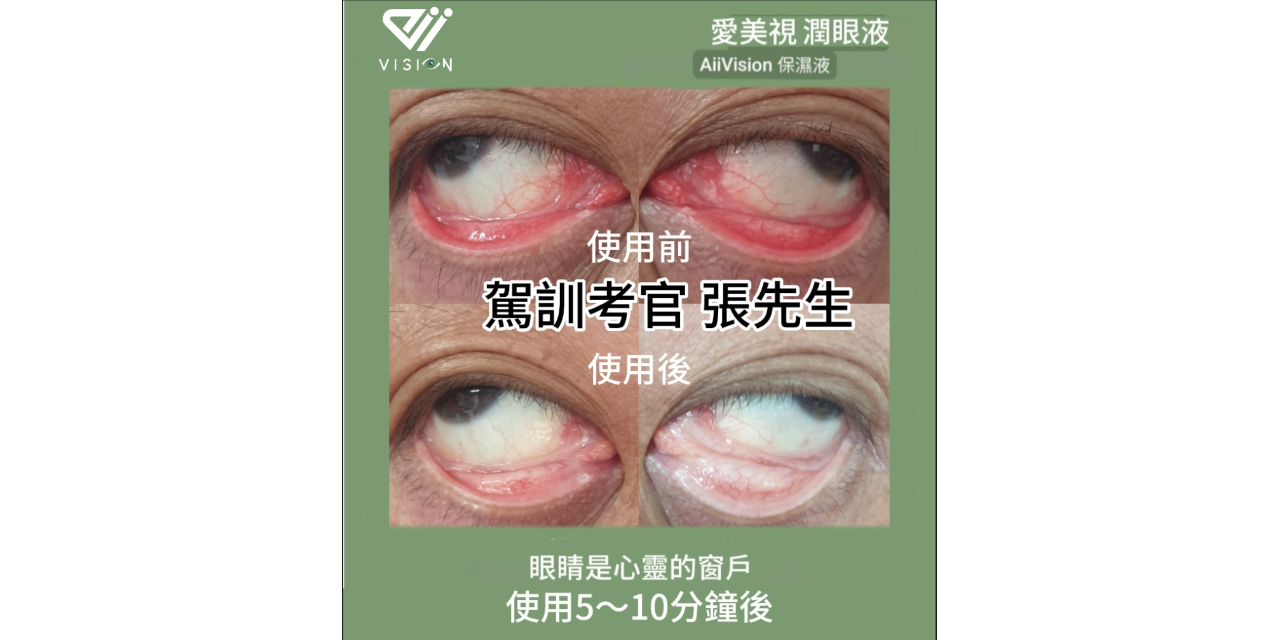 愛美視 護眼液 保護您