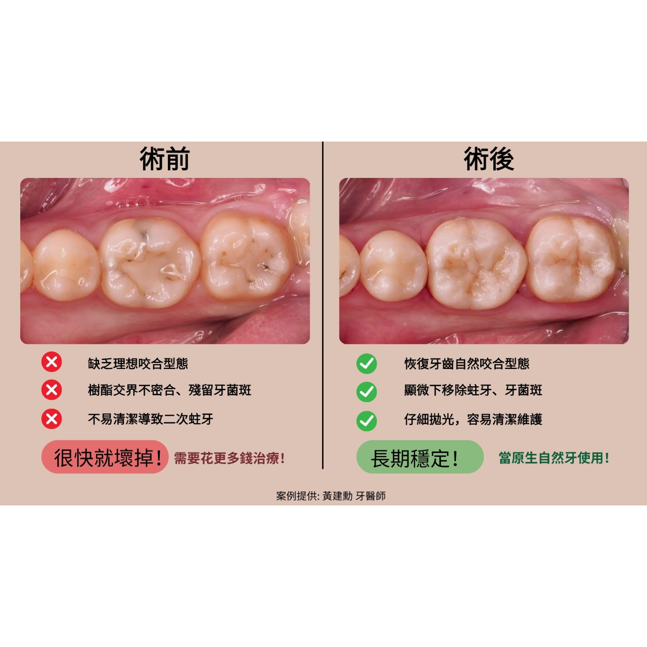 黃建勳 牙醫師 術後