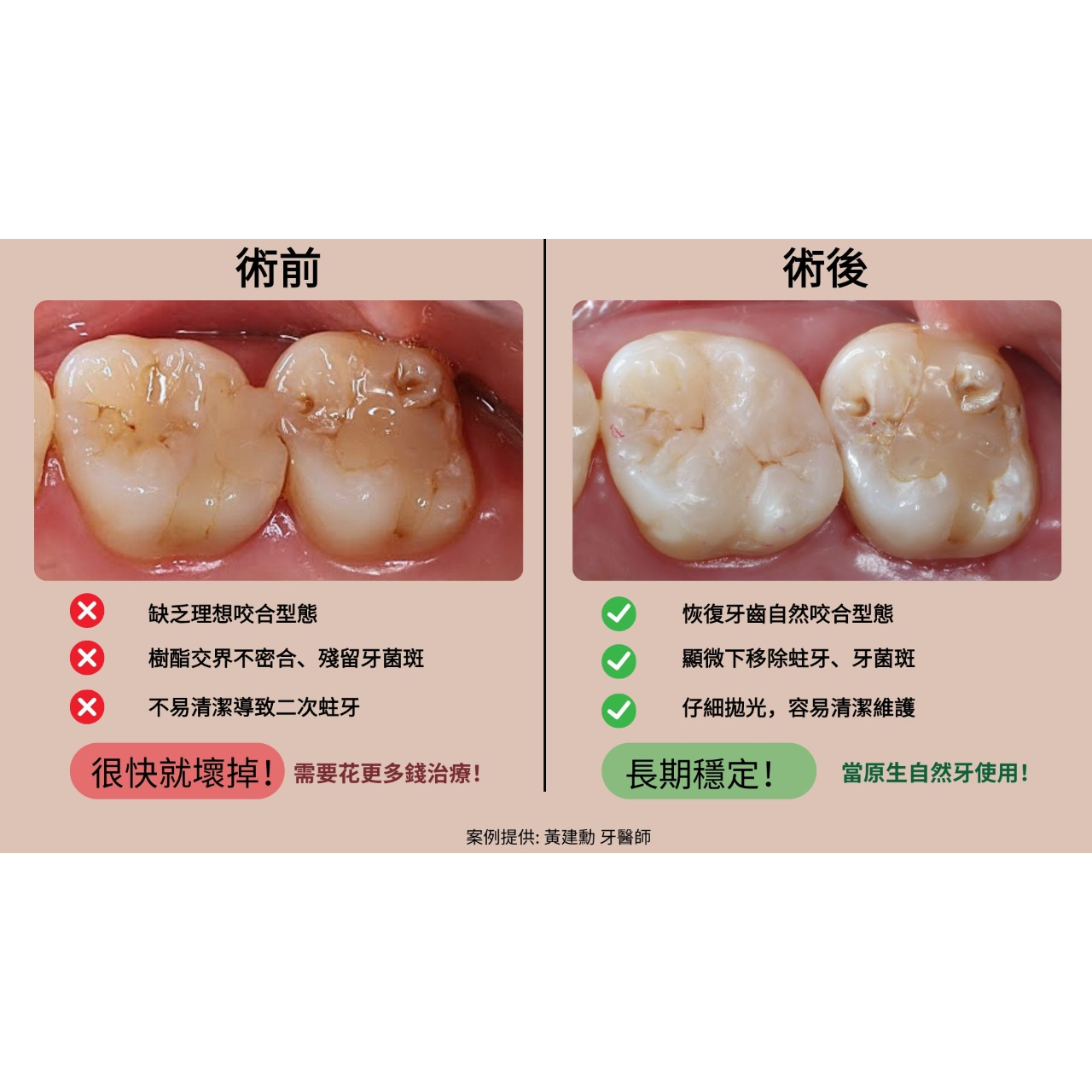 黃建勳 牙醫師 術前